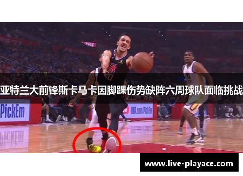 亚特兰大前锋斯卡马卡因脚踝伤势缺阵六周球队面临挑战